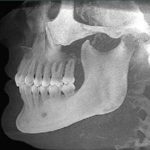 X ray of human jaw